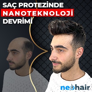 Protez saç istanbul