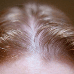 Thin Stranded Hair