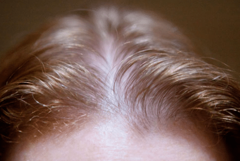 Thin Stranded Hair