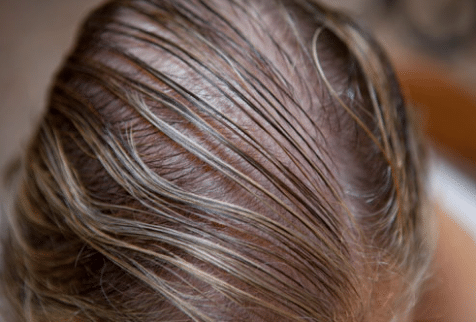 Thin Hair Treatments