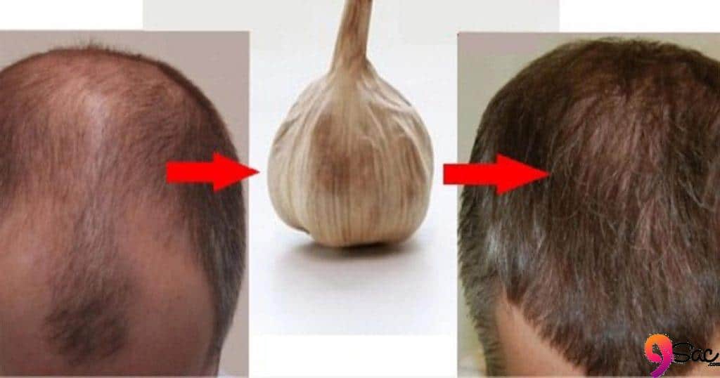 Plowing Garlic on Hair